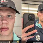 Bizarne zranenie norskej hviezdy Haalanda