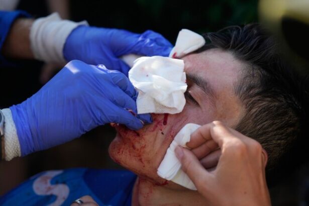 Krvave zranenie na Tour Prerazil sklo aut a ma 20 stehov Jazdec timu Movistar musel odstupit