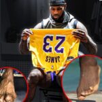 Taziva diagnoza mu zmenila nohy na nepoznanie LeBron James vladne aj napriec bolestiam